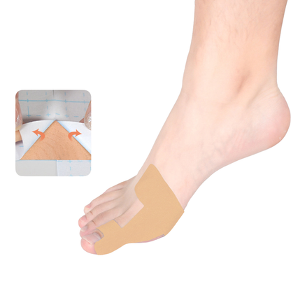 ToeBandage: Bekväm Tåjusteringsbandage Stödset