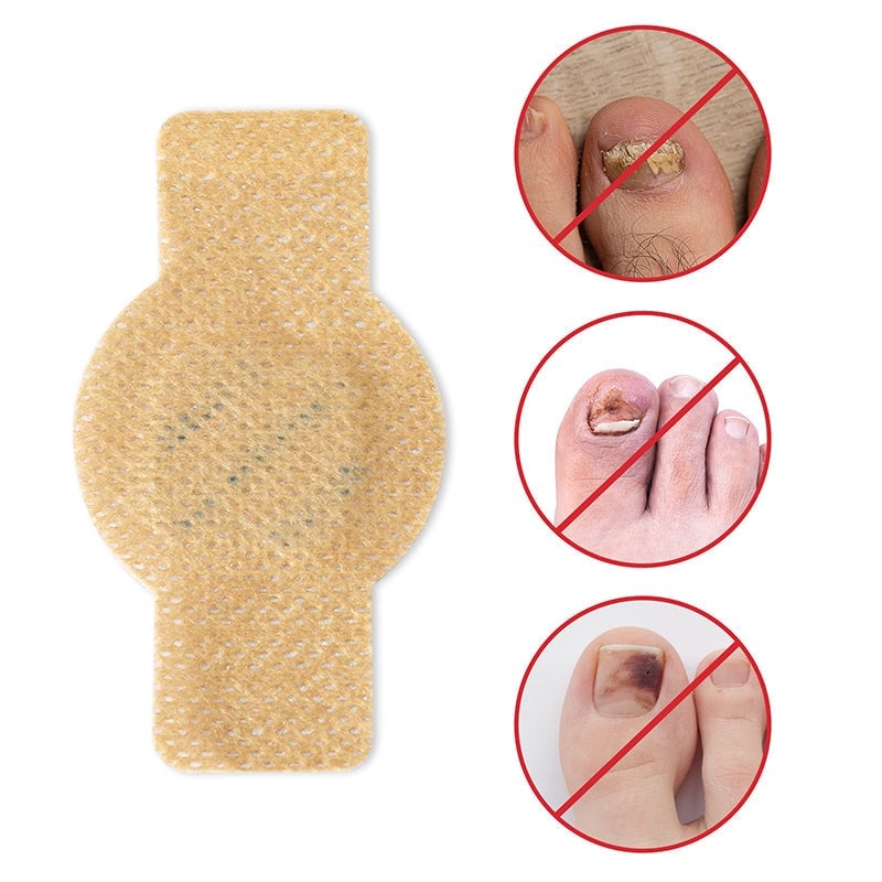 FungalPatch - Antibakteriell Svampplåster Och Nagelvårds Pack